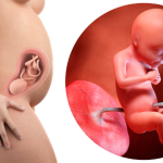 Dra. Thaline Neves explica o que é bem-estar fetal e como exames específicos ajudam a monitorar a saúde do bebê durante a gestação.